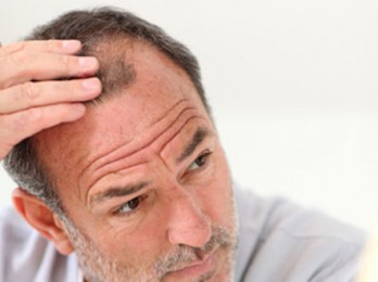 Предотвращение выпадения волос у женщин и мужчин