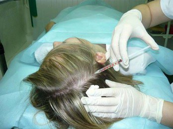 Лечение себореи у детей на голове
