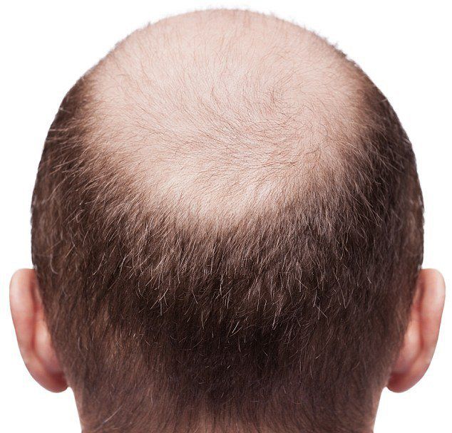 Почему черные волосы на голове у мужчин